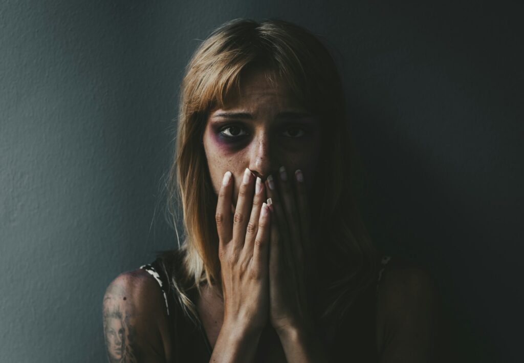 Beaten woman standing in front of a dark wall demonstrating violence on women.