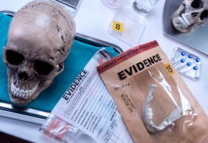 Human skull of a murdered adult in forensic lab, conceptual image