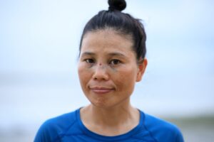 Woman with injured eyes